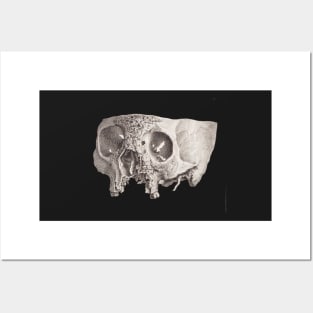 Diseased Skull, Unknown Posters and Art